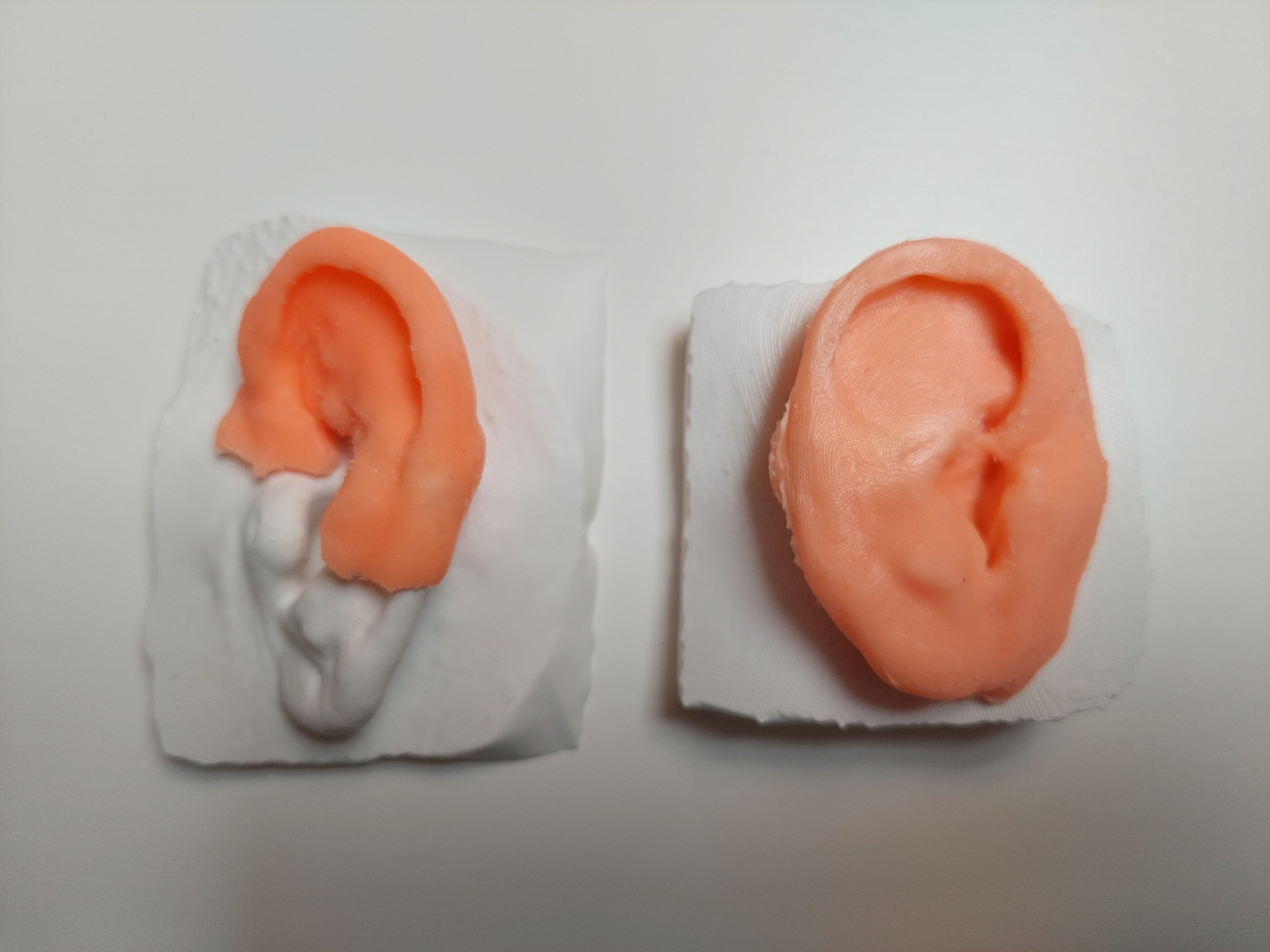 3d-printed-ears-are-being-tested-on-patients.jpg
